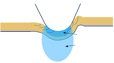 Diagram showing tensile and compressive stress zones in coating and substrate during indenter contact in scratch test